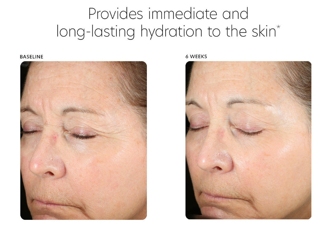 hyaluronic acid boosting serum 3