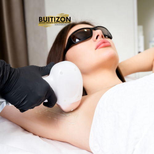 laser underarm